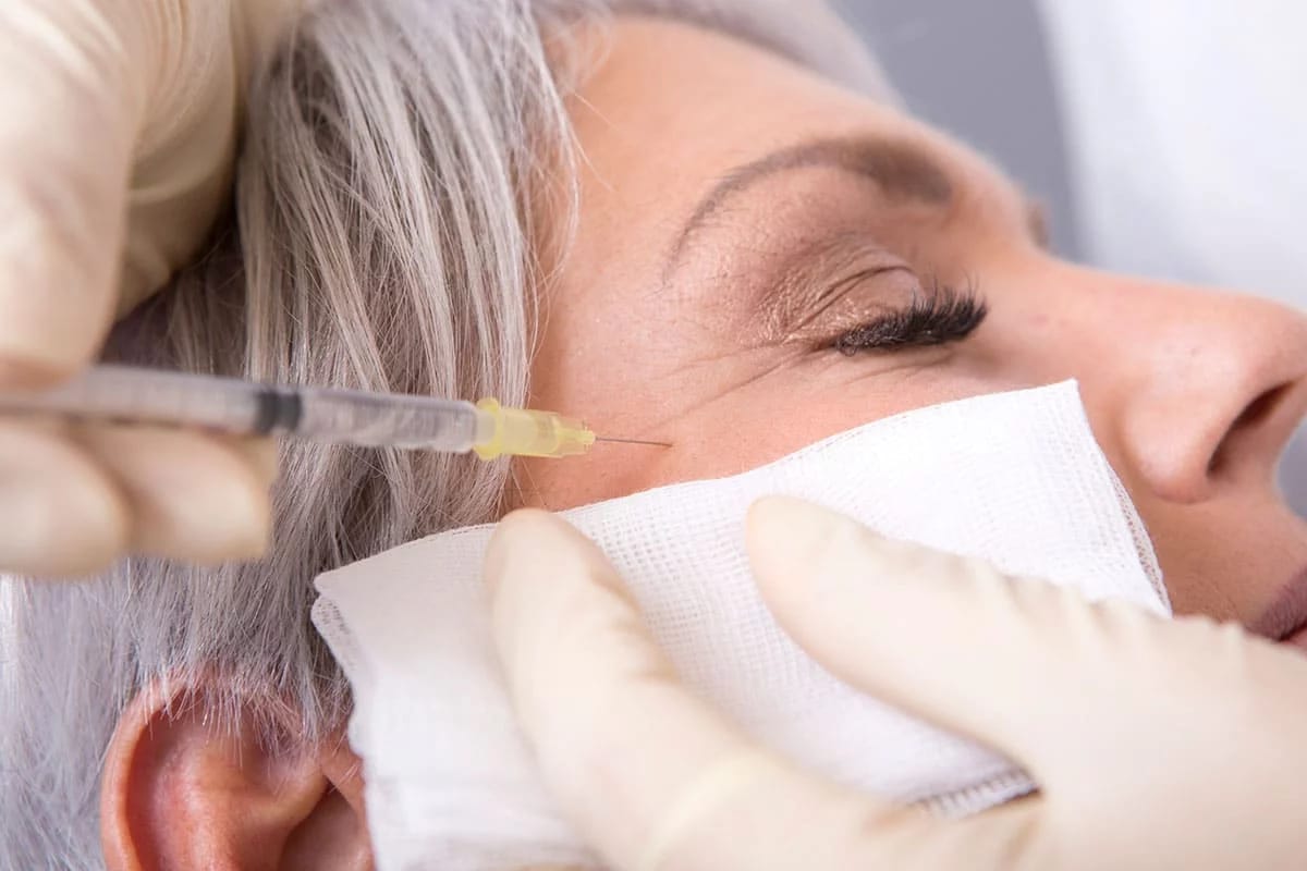 Botox Nürnberg: Ästhetik trifft Technik